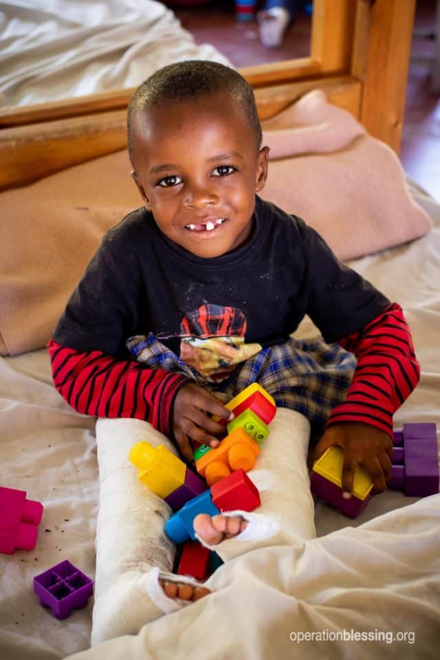 Sadiki smiles with casts on his legs after his transforming surgery.