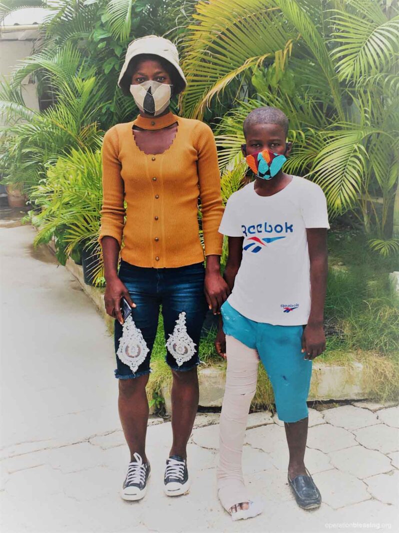 femoral fracture in haiti