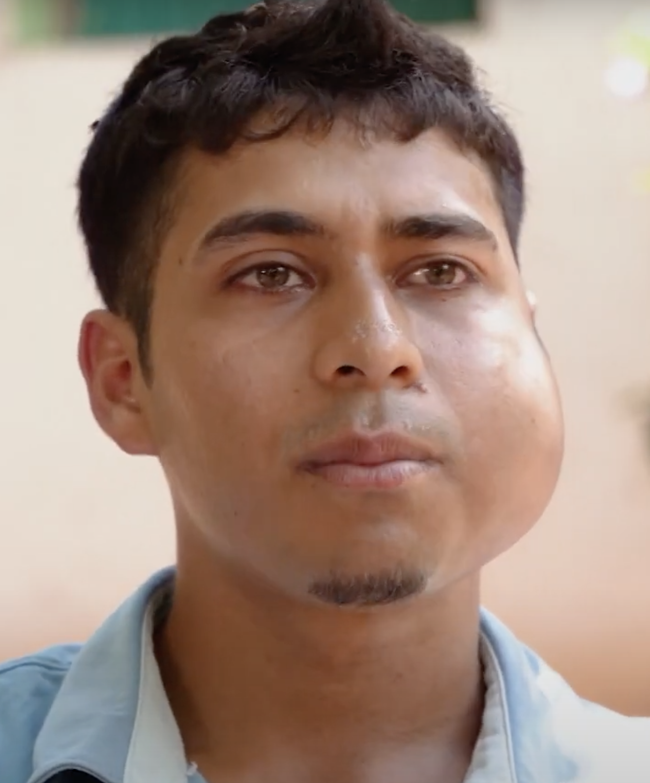 tumor patient honduras