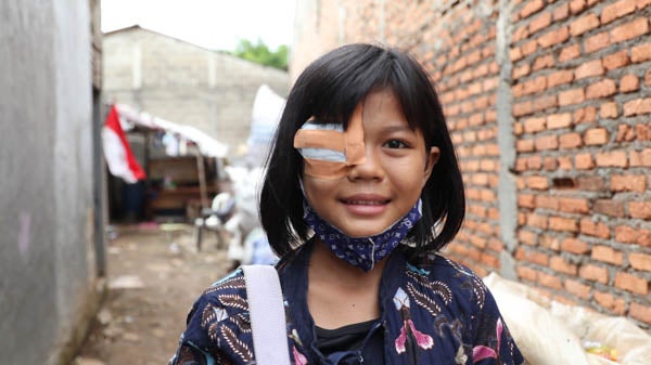 eye-surgery-indonesia