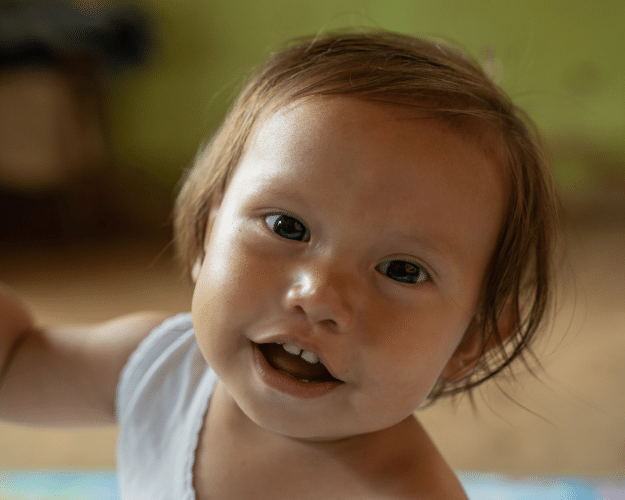 surgery in peru for a child named Jordano with deformed feet