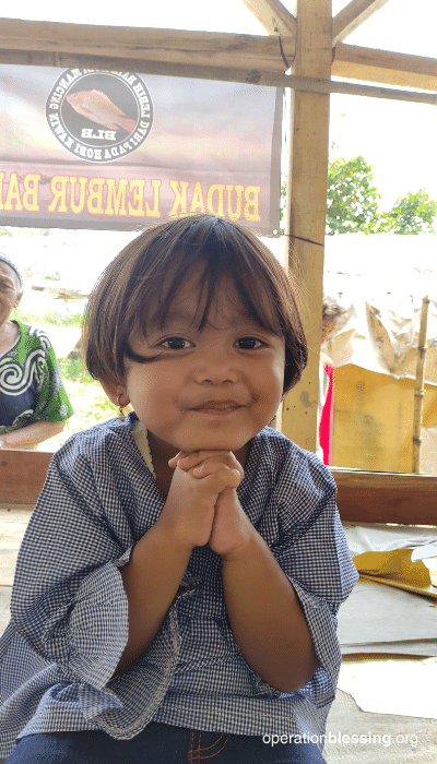 indonesia child clubfoot