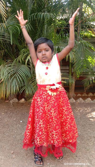 indian child recieves surgery for shoulder deformity