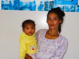 cleft lips surgery in cambodia for child