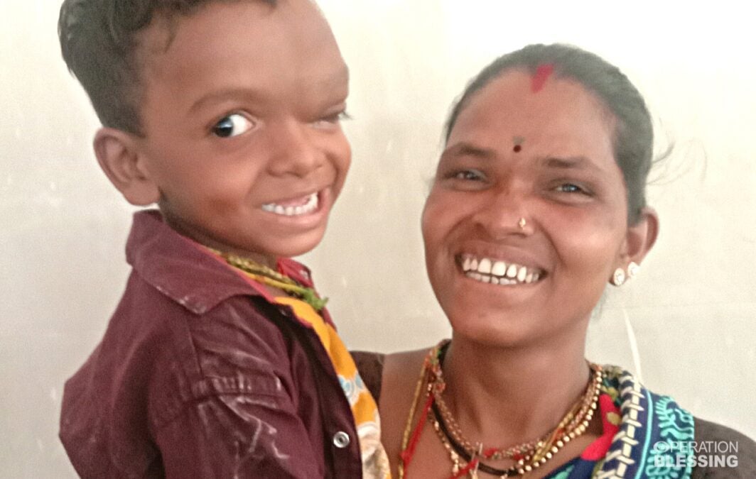 surgery for a child in need in India