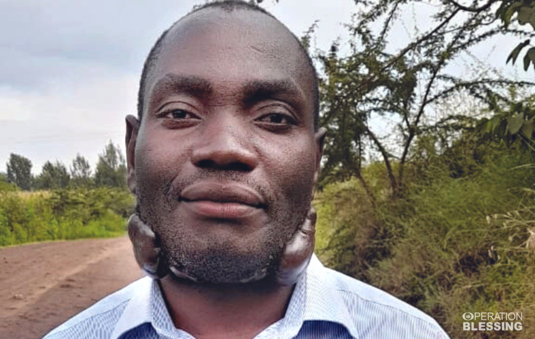 pastor afflicted with keloids in Kenya
