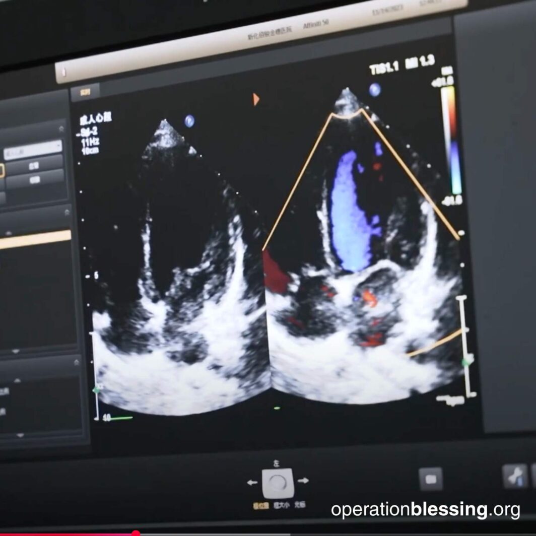 Operation Blessing provided the surgery
