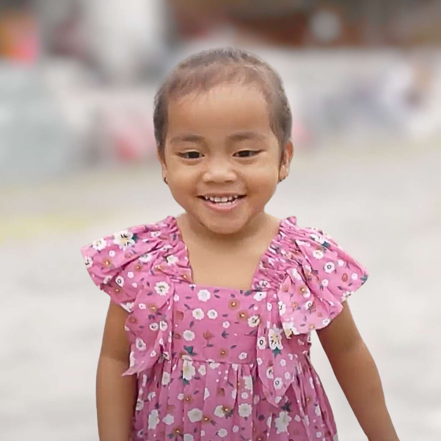 born with bilateral clubfeet