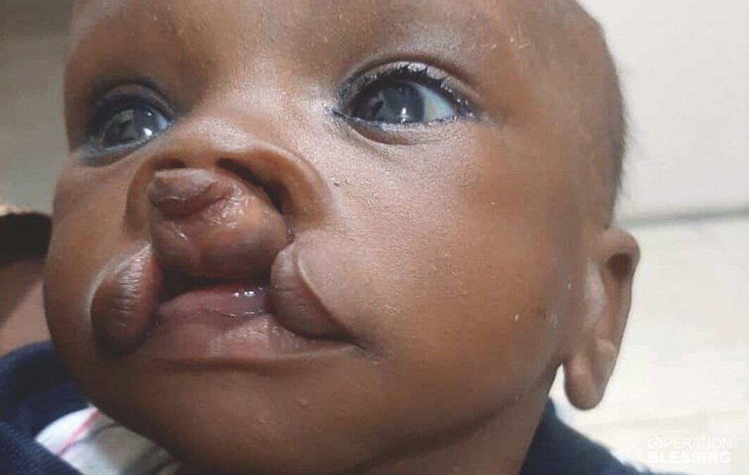 life changing surgery charity
